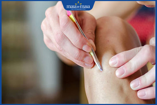 Nhổ lông chân có mọc lại không? Làm sao dọn lông chân hiệu quả? 2 nhổ lông chân vẫn mọc lại