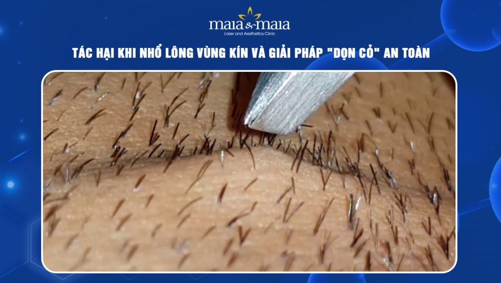 Tác hại khi nhổ lông vùng kín và giải pháp "dọn cỏ" an toàn 1 Nhổ lông vùng kín