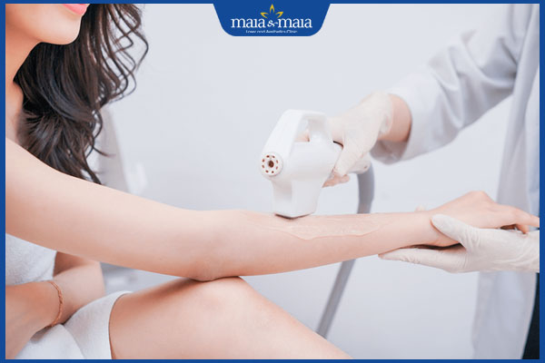 Quy trình triệt lông