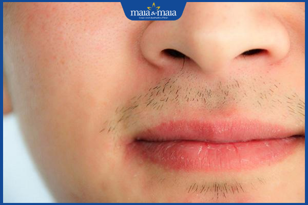 15 tuổi có nên cạo râu không? Lưu ý khi thực hiện  2 râu mọc