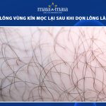 thời gian lông vùng kín mọc lại