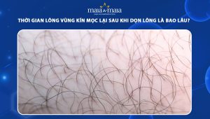 Thời gian lông vùng kín mọc lại sau khi dọn lông là bao lâu? 58 thời gian lông vùng kín mọc lại