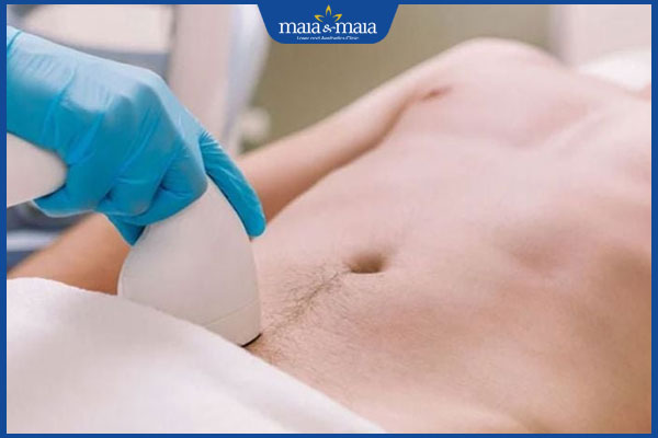 thực hiện triệt lông vùng kín cho nam giới