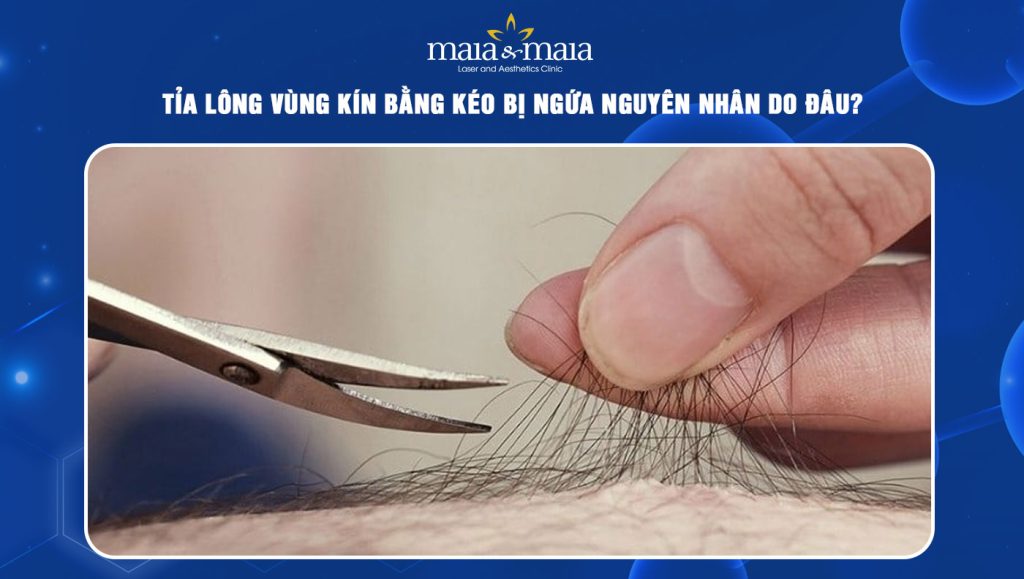 Tỉa lông vùng kín bằng kéo bị ngứa: Nguyên nhân và cách khắc phục 1 tỉa lông vùng kín bằng kéo bị ngứa