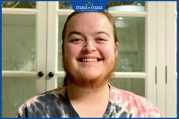 Con gái có râu quai nón có sao không? Cách xử lý hiệu quả 2 tình trạng con gái có râu