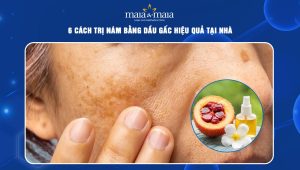 Điểm danh 6 cách trị nám bằng dầu gấc hiệu quả tại nhà 106 cách trị nám bằng dầu gấc