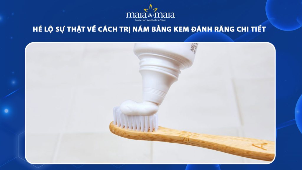 cách trị nám bằng kem đánh răng