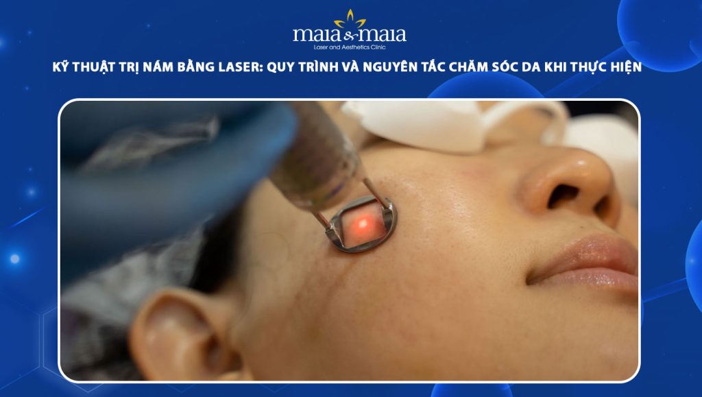 trị nám bằng laser