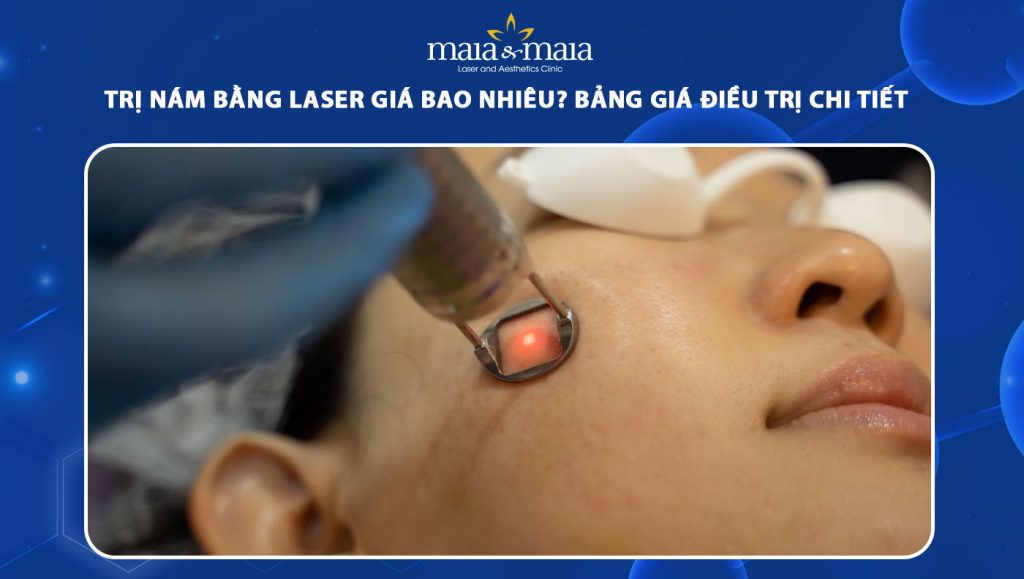 trị nám bằng laser giá bao nhiêu