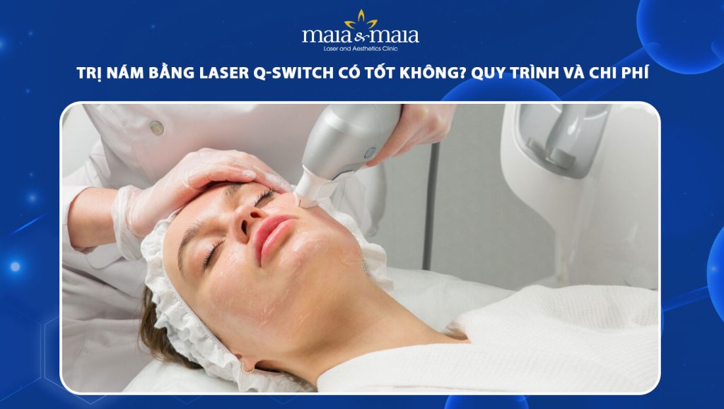Trị nám bằng laser Q-Switch