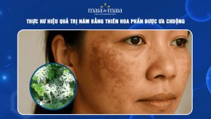 Thực hư hiệu quả trị nám bằng thiên hoa phấn được ưa chuộng 105 trị nám bằng thiên hoa phấn