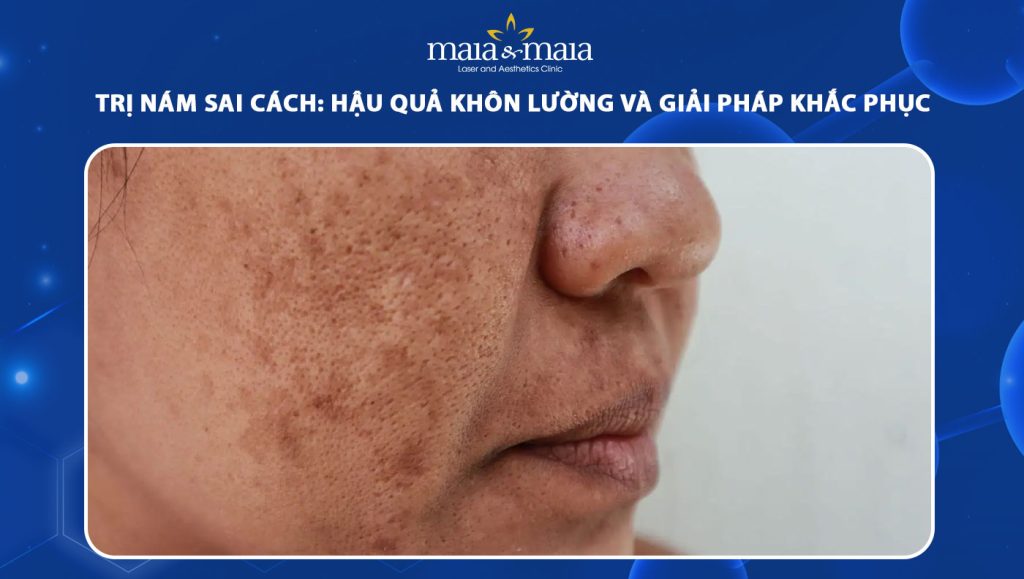 trị nám sai cách