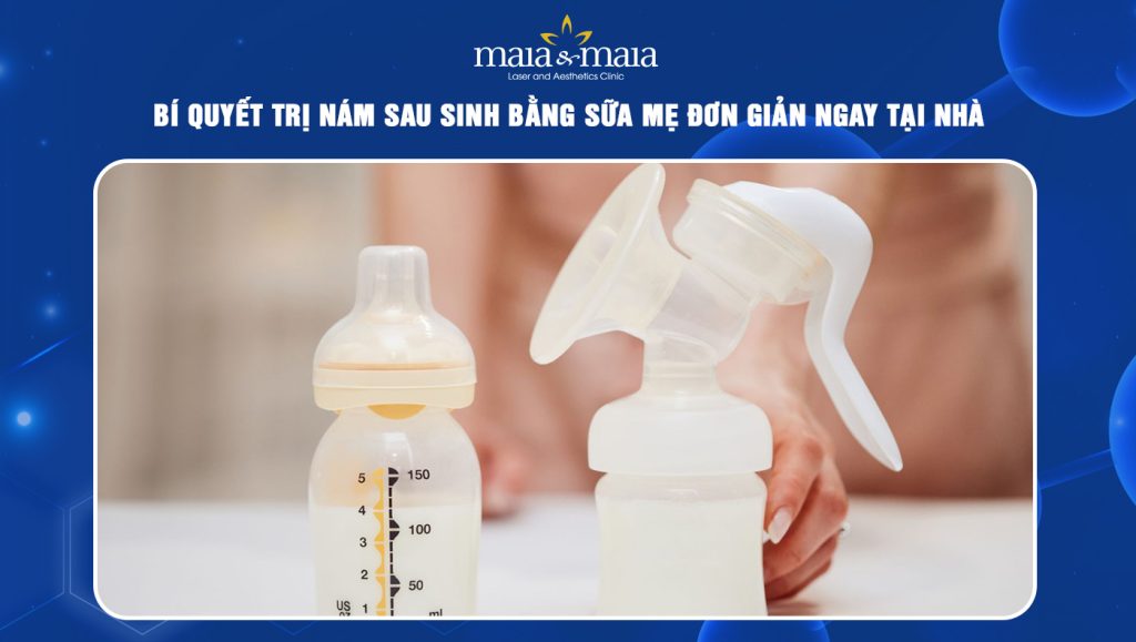 trị nám sau sinh bằng sữa mẹ