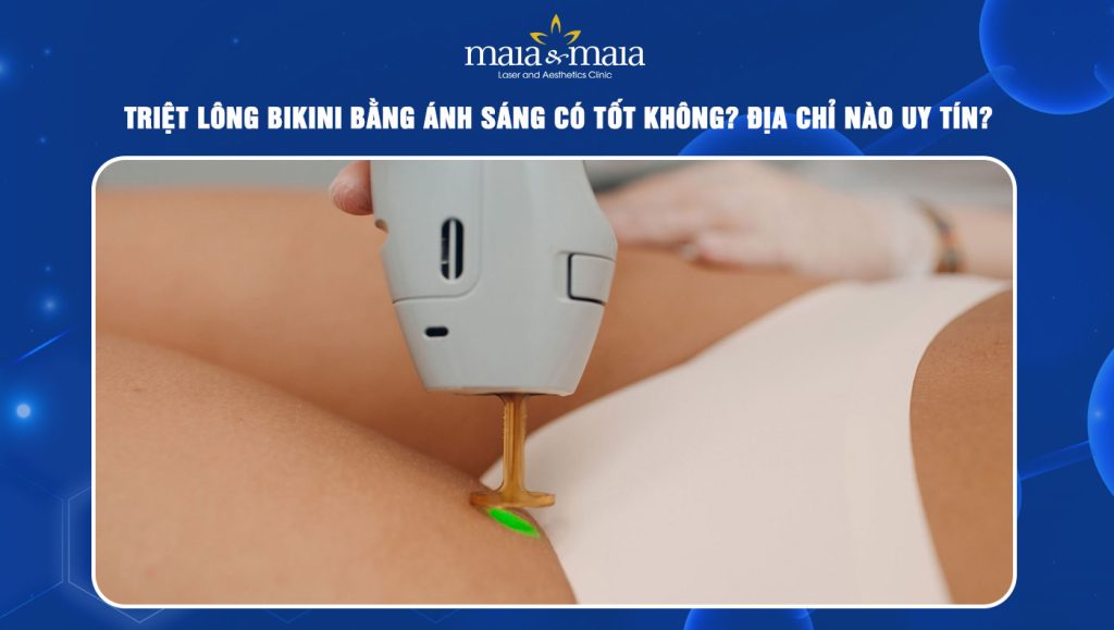 triệt lông bikini bằng ánh sáng
