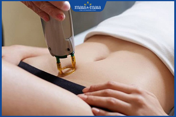 Triệt lông bikini bằng ánh sáng có tốt không? Địa chỉ nào uy tín? 4 triệt lông bikini đúng kỹ thuật