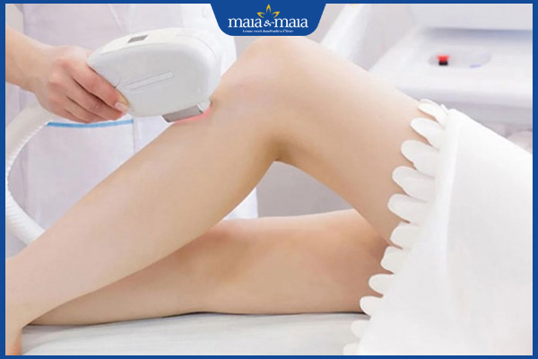 Có nên cạo lông chân ở tuổi dậy thì không? Lưu ý khi dọn lông chân 4 triệt lông chân bằng công nghệ cao