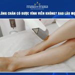 triệt lông chân có được vĩnh viễn không