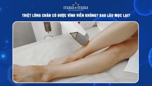 Triệt lông chân có được vĩnh viễn không? Bao lâu mọc lại? 77 triệt lông chân có được vĩnh viễn không
