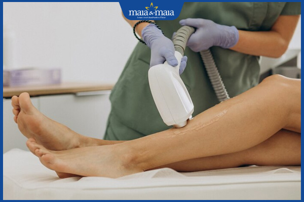 Nổi mẩn đỏ sau khi triệt lông chân: Cách khắc phục và ngăn ngừa 2 triệt lông chân sai kỹ thuật