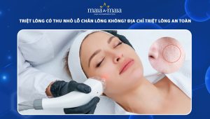 Triệt lông có thu nhỏ lỗ chân lông không? Địa chỉ triệt lông an toàn 95 triệt lông có thu nhỏ lỗ chân lông không
