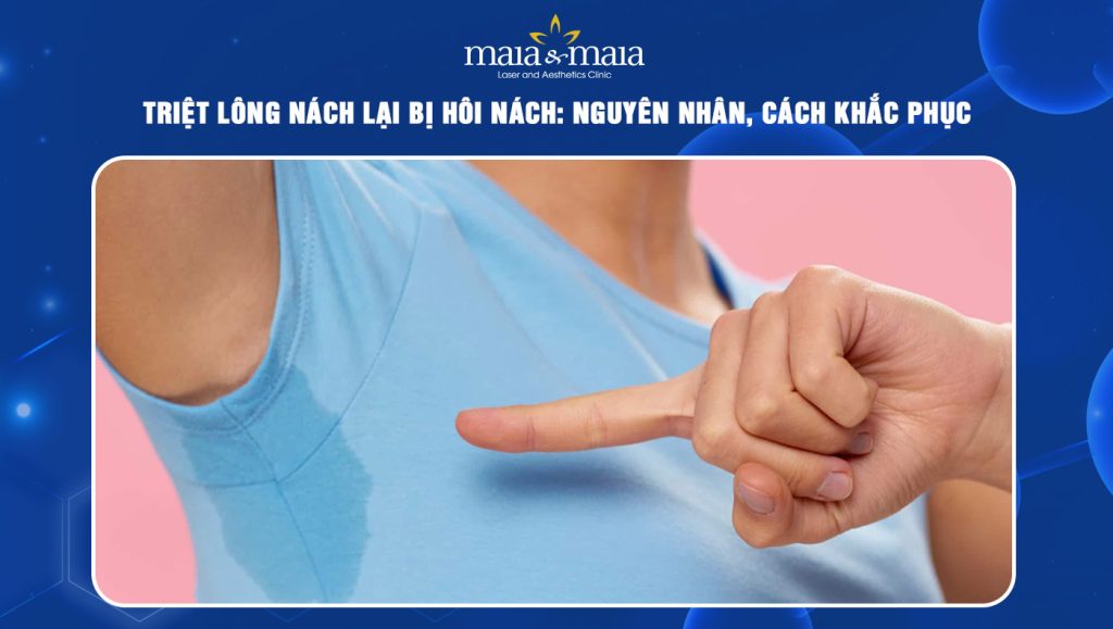 triệt lông nách lại bị hôi nách