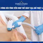 triệt lông vùng kín vĩnh viễn