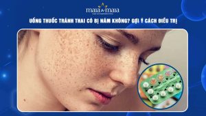 Uống thuốc tránh thai có bị nám không? Gợi ý cách điều trị 81 uống thuốc tránh thai có bị nám không
