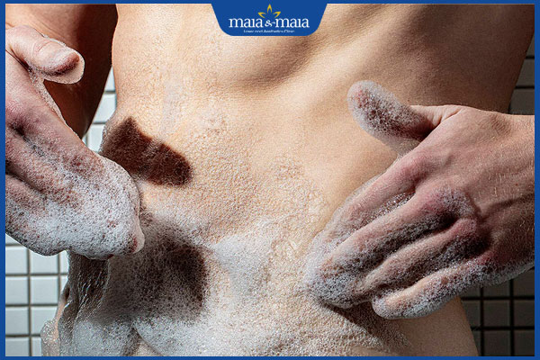 Đốm trắng ở bìu do đâu? Cách chăm sóc điều trị hiệu quả 4 vệ sinh vùng kín nam