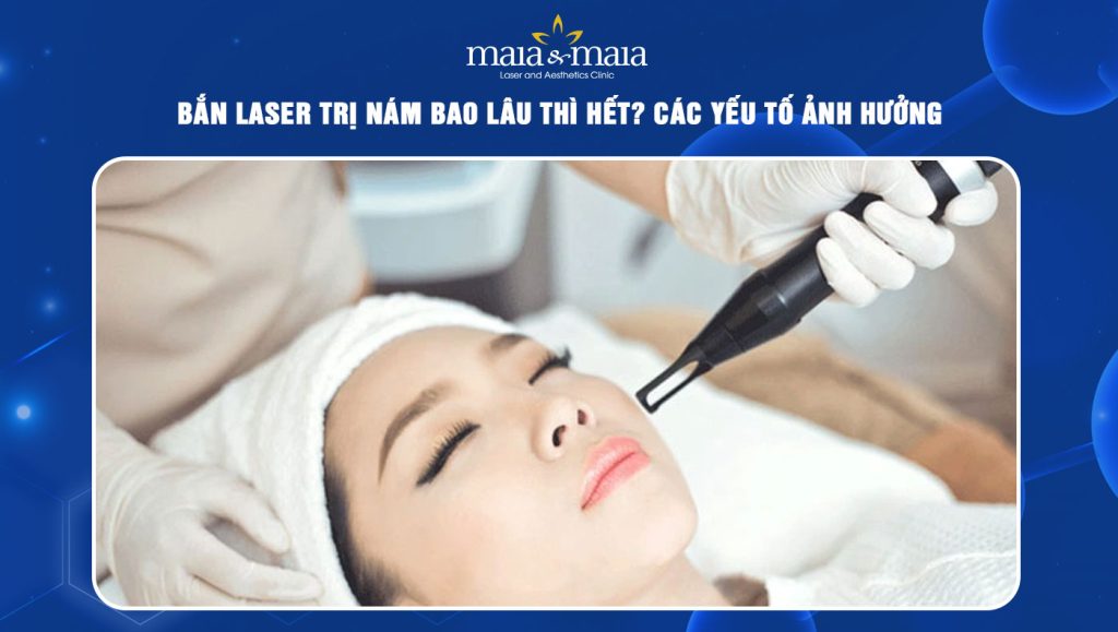 bắn laser trị nám bao lâu thì hết