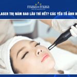 bắn laser trị nám bao lâu thì hết