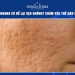 bắn tàn nhang có để lại sẹo không