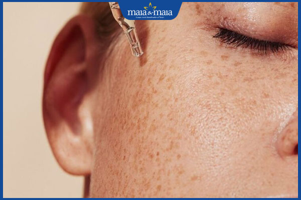Cấu trúc da nám là gì? Giải mã chi tiết và cách điều trị  3 bôi serum tri nam