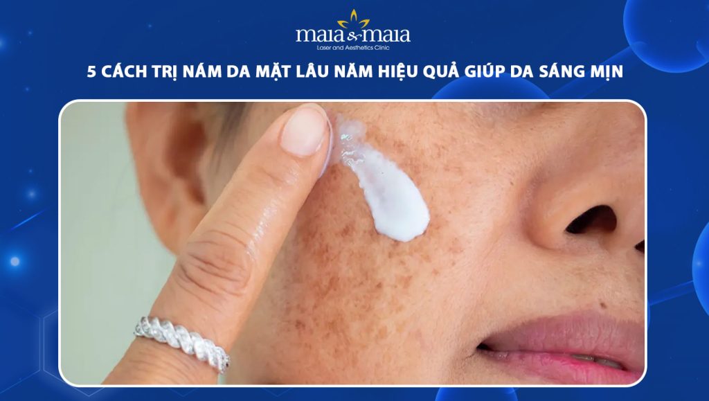 cách trị nám da mặt lâu năm