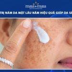 cách trị nám da mặt lâu năm