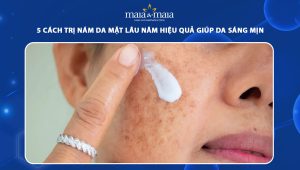 5 cách trị nám da mặt lâu năm hiệu quả giúp da sáng mịn 74 cách trị nám da mặt lâu năm