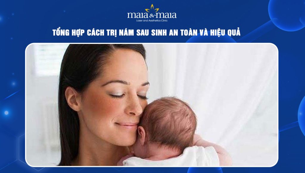 Tổng hợp cách trị nám sau sinh an toàn và hiệu quả 1 cách trị nám sau sinh