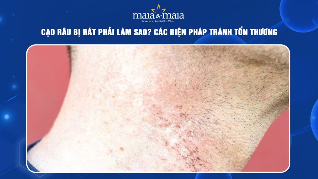 Cạo râu bị rát phải làm sao? Các biện pháp tránh tổn thương 1 cạo râu bị rát