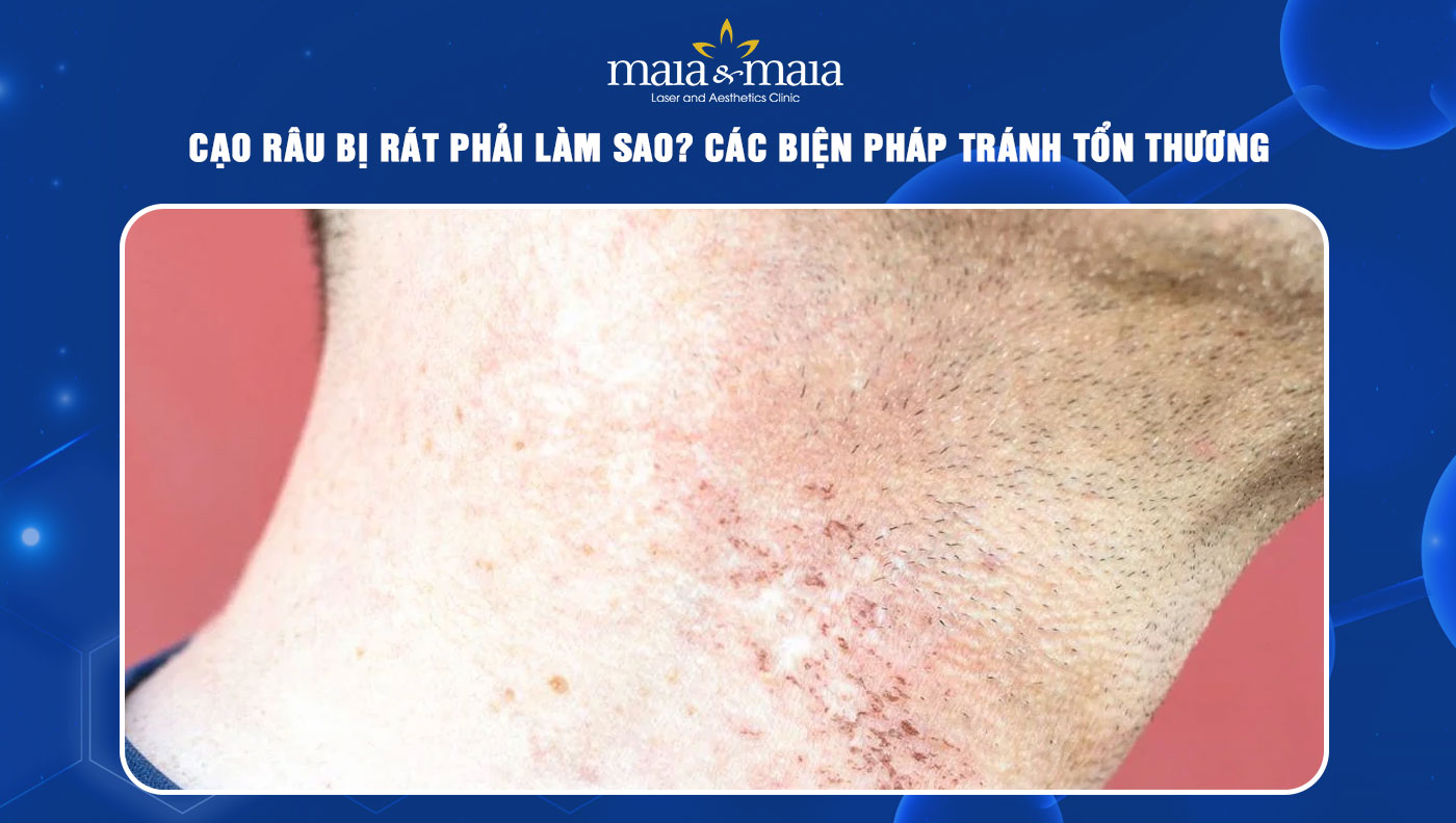 Cạo râu bị rát phải làm sao? Các biện pháp tránh tổn thương 23 cạo râu bị rát