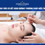 cấy collagen tươi có hết nám không