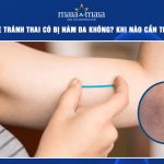 cấy que tránh thai có bị nám da không