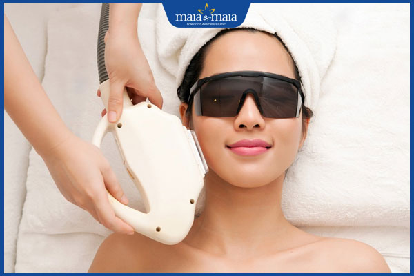 chiếu ánh sáng ipl