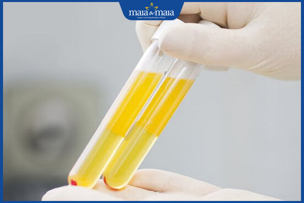 Trị nám bằng PRP: Quy trình thực hiện, hiệu quả và lưu ý  2 công dụng của prp