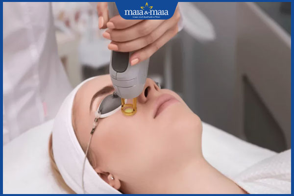 công nghệ điều trị nám