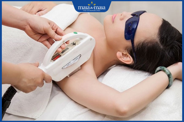 công nghệ diode laser triệt lông nách