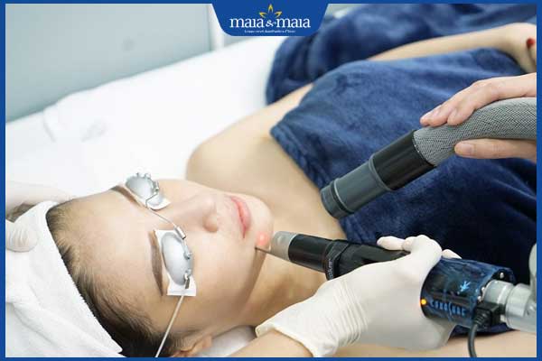 Nám chân đinh là gì? Bí quyết xóa nám tận gốc nhanh chóng 3 công nghệ laser picosure