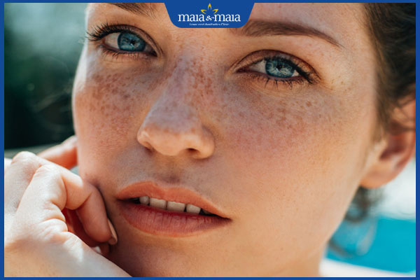 Nám hori: Dấu hiệu nhận biết và phương pháp điều trị hiệu quả 2 đặc điểm của nám hori