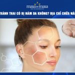 đặt vòng tránh thai có bị nám da không