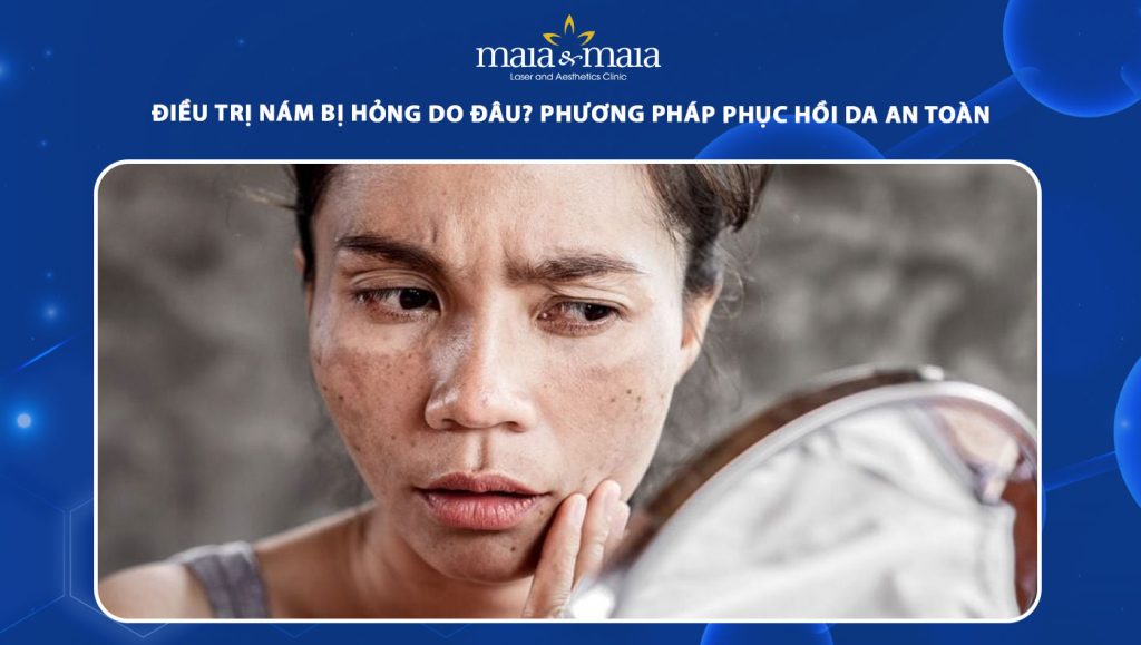 Điều trị nám bị hỏng do đâu? Phương pháp phục hồi da an toàn 1 điều trị nám bị hỏng