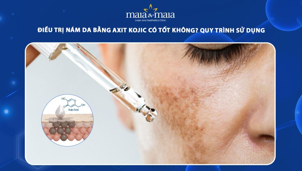 Điều trị nám da bằng Axit Kojic có tốt không? Quy trình sử dụng an toàn 1 điều trị nám da bằng axit kojic