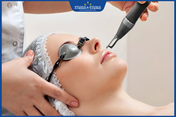 điều trị nám ở miệng bằng công nghệ